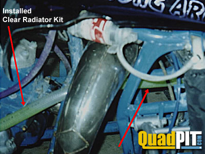 Clear Radiator Kit